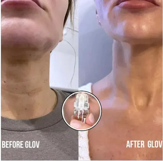 FIRMING MICRO NEEDLE FACIAL SERUM